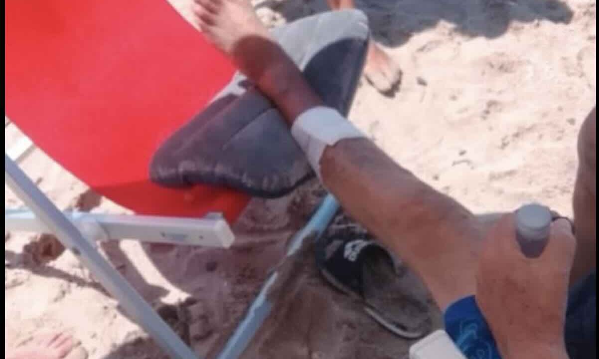 Cilento: due turisti feriti in pochi giorni da morsi di pesci, residenti preoccupati