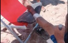 Cilento: due turisti feriti in pochi giorni da morsi di pesci, residenti preoccupati