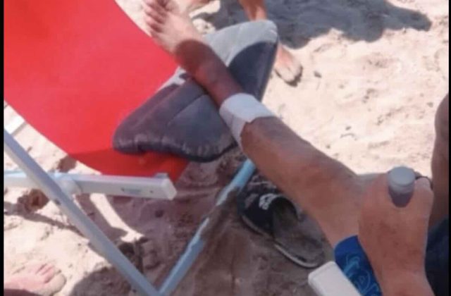 Cilento: due turisti feriti in pochi giorni da morsi di pesci, residenti preoccupati