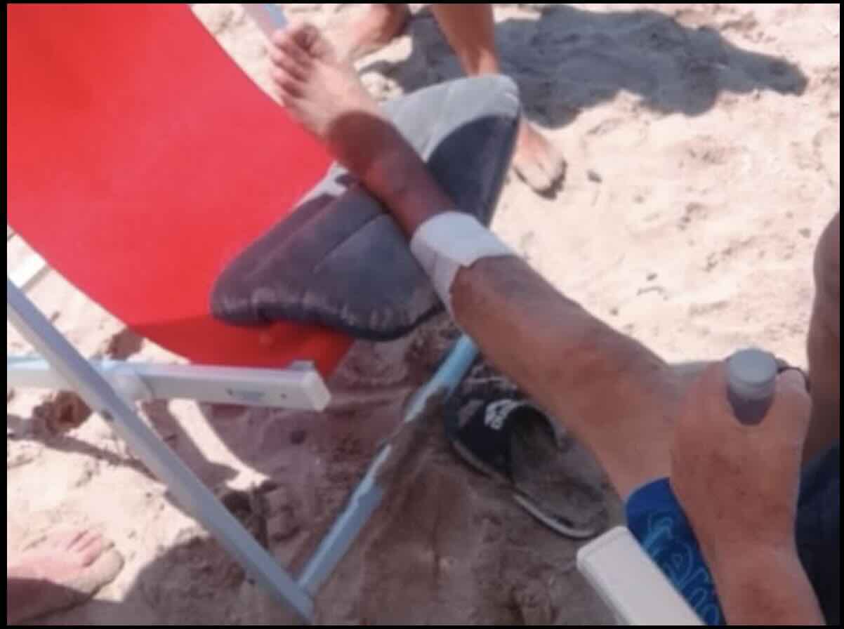 Cilento: due turisti feriti in pochi giorni da morsi di pesci, residenti preoccupati