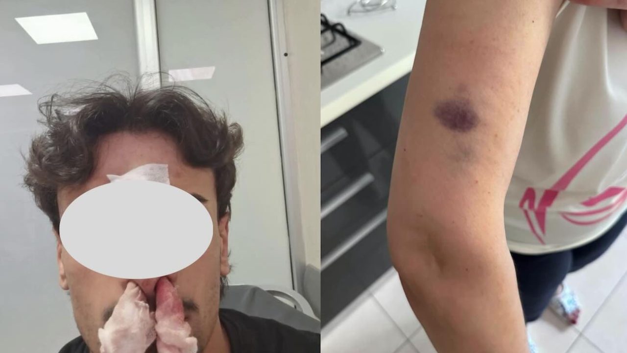 Casoria, aggressione in casa per un parcheggio disabili: il gesto eroico di un ragazzo per proteggere la madre