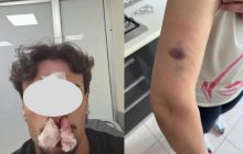 Casoria, aggressione in casa per un parcheggio disabili: il gesto eroico di un ragazzo per proteggere la madre