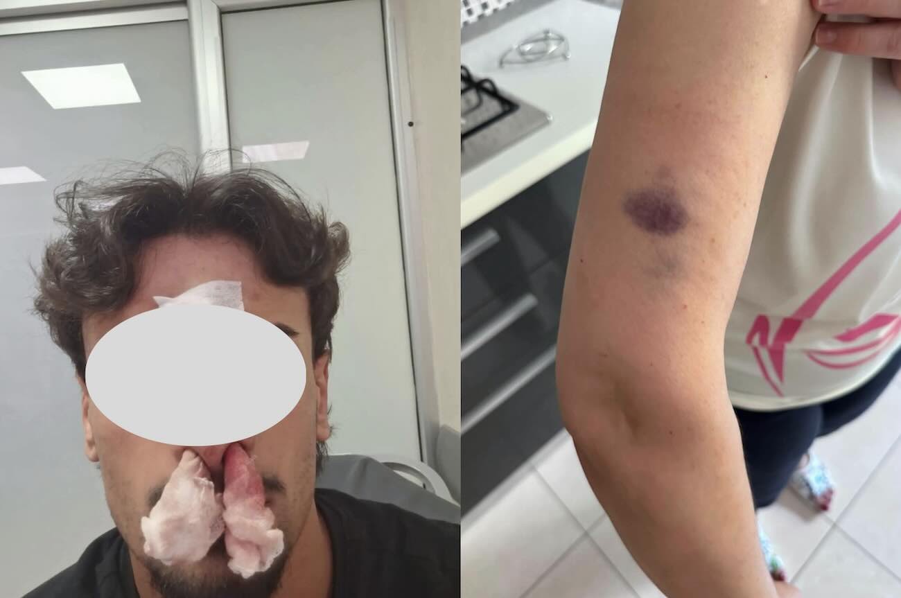Casoria, aggressione in casa per un parcheggio disabili: il gesto eroico di un ragazzo per proteggere la madre