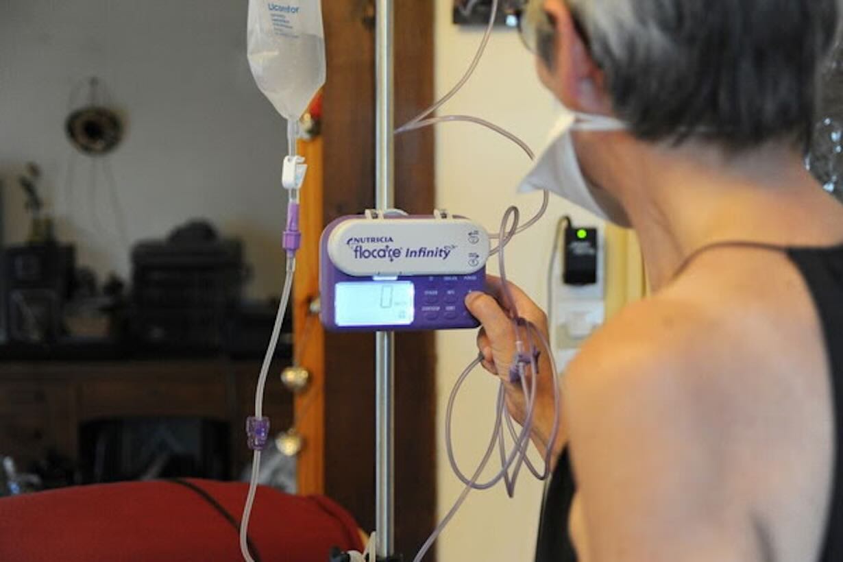 Digiuno intermittente: come mantenere il peso in forma anche dopo un anno a Napoli