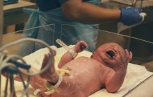 Scambio di embrioni a Napoli: una coppia indaga per scoprire l’origine della loro bambina non biologica.x