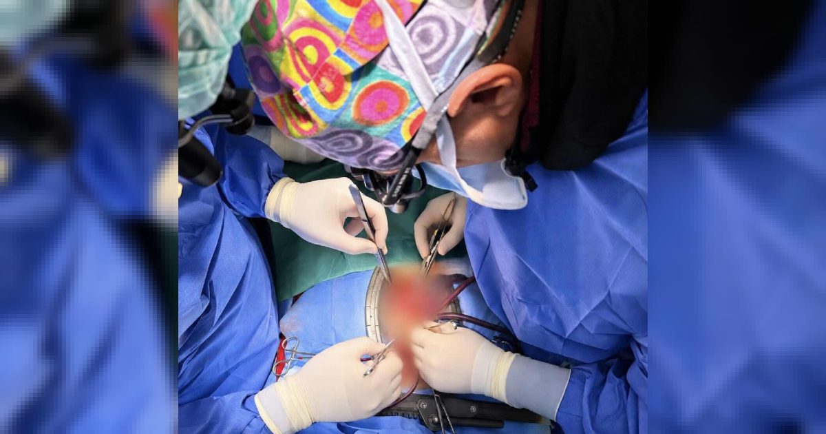 Napoli: Monaldi ospita la seconda donazione a cuore fermo, fegato e cornee per i trapianti regionali
