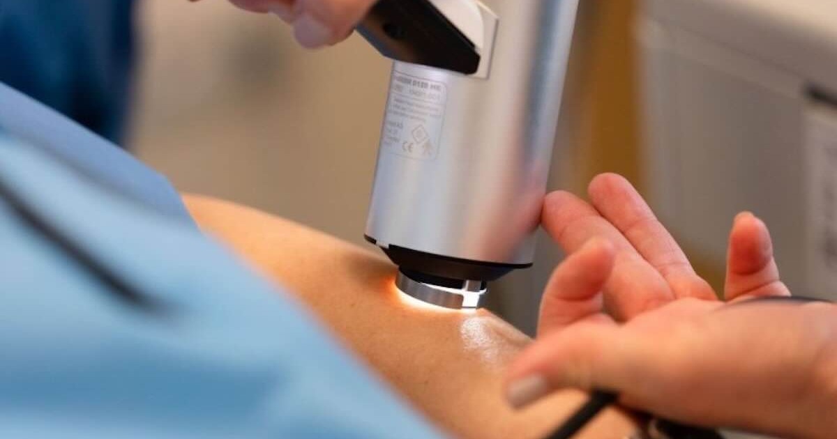 Studio rivela il segreto del melanoma: come le cellule tumorali eludono il sistema immunitario e potrebbero rendere obsolete le terapie attuali